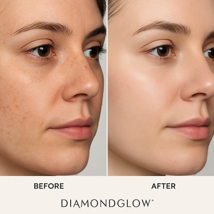 before and after diamondglow-1