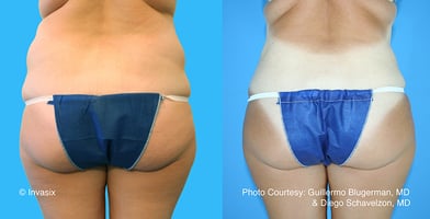 body-by-dr-guillermc-blugerman-preview-1-800-w