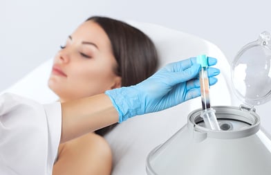 prp-image-1