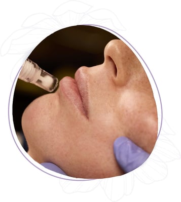 skin-pen-about