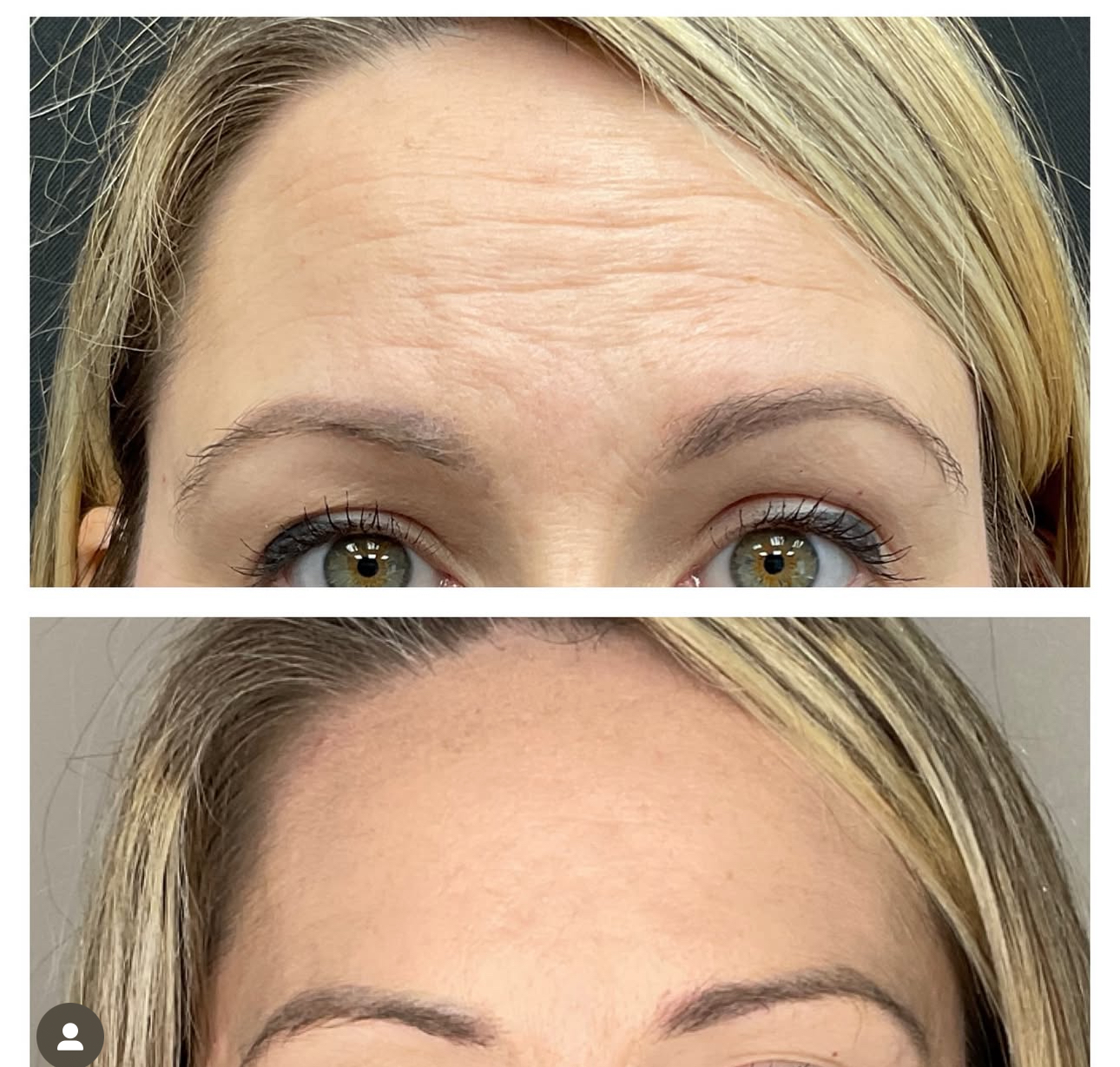 before,after before,after